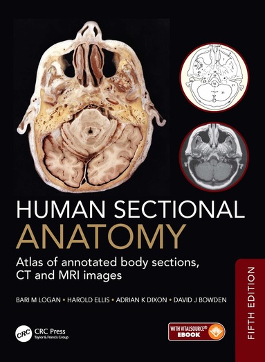 Bari M Logan, Harold Ellis, Adrian K Dixon, David J Bowden - Human Sectional Anatomy, Inbunden