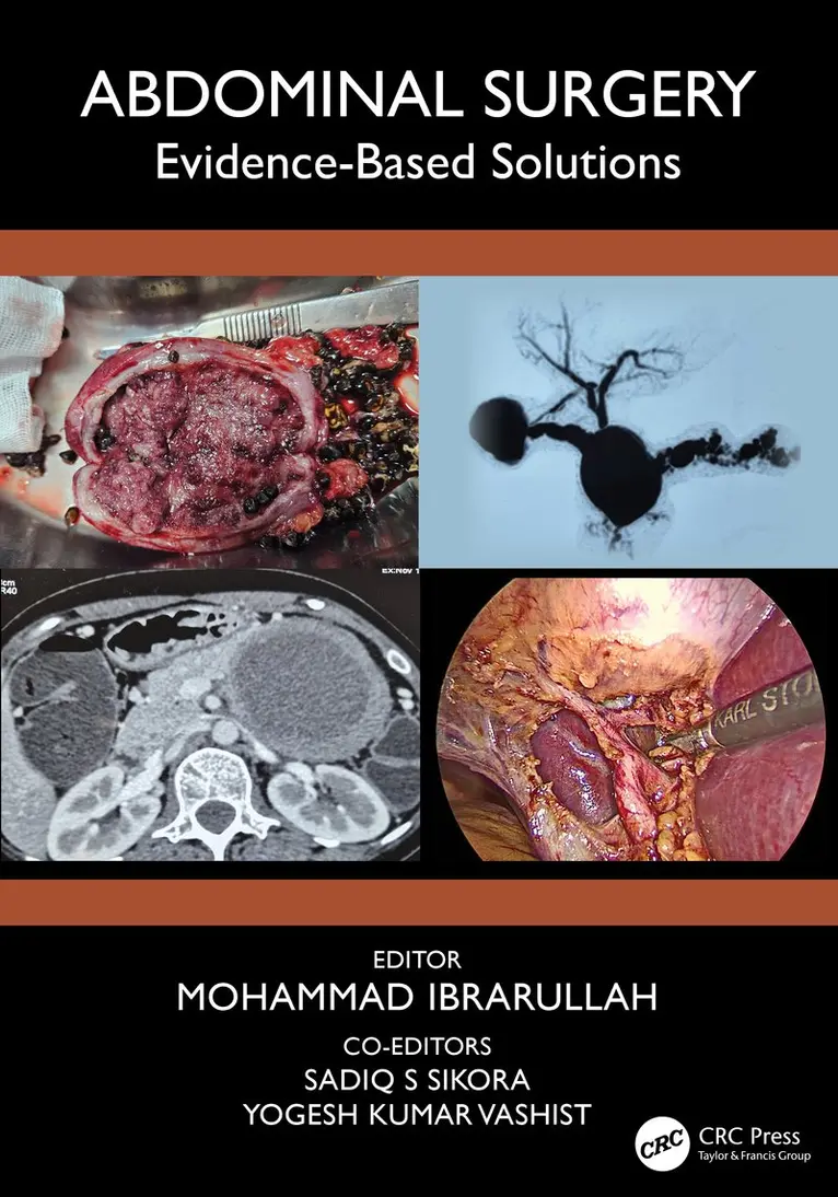 Mohammad Ibrarullah, Yogesh Kumar Vashist, Sadiq S Sikora - Abdominal Surgery, Häftad. Tillgänglighet: Kommande