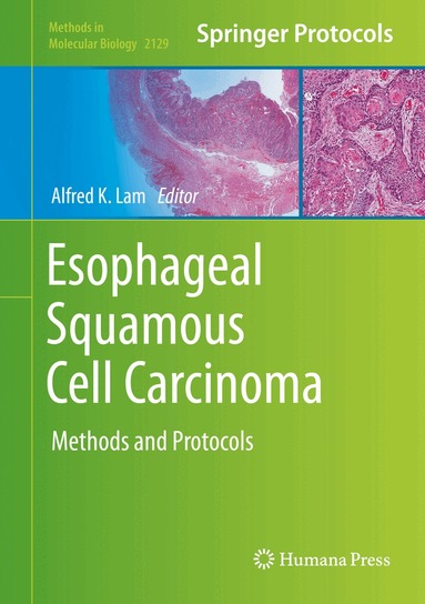 Alfred K. Lam - Esophageal Squamous Cell Carcinoma, Inbunden