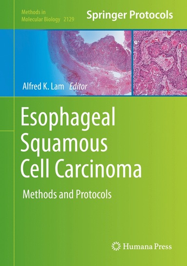 bokomslag Esophageal Squamous Cell Carcinoma