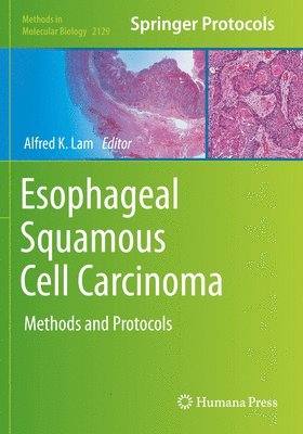 bokomslag Esophageal Squamous Cell Carcinoma