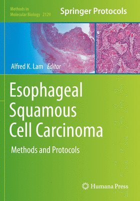 Esophageal Squamous Cell Carcinoma 1