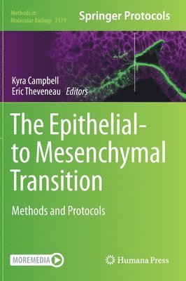 Kyra Campbell, Eric Theveneau - Epithelial-to Mesenchymal Transition, Inbunden