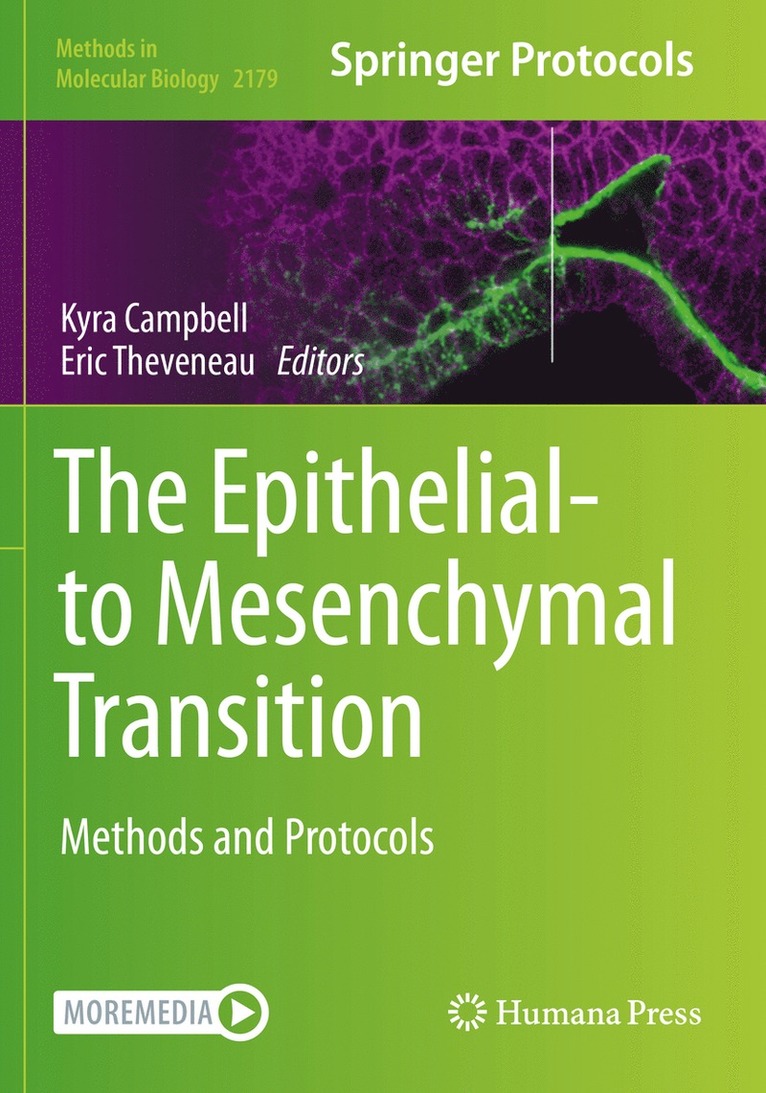 Epithelial-to Mesenchymal Transition