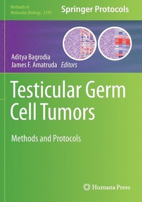 Testicular Germ Cell Tumors 1