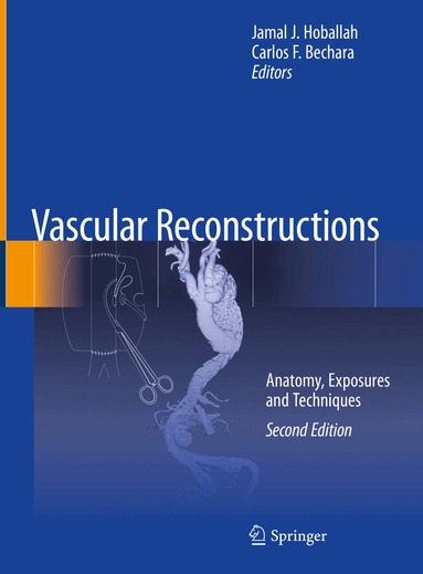 Jamal J. Hoballah, Carlos F. Bechara - Vascular Reconstructions, Inbunden