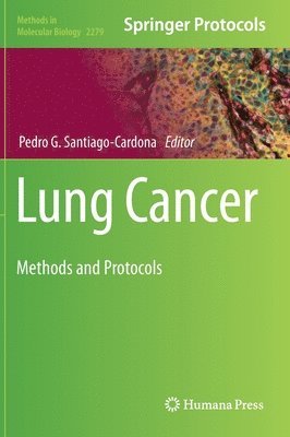 bokomslag Lung Cancer