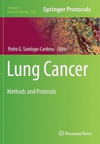 bokomslag Lung Cancer