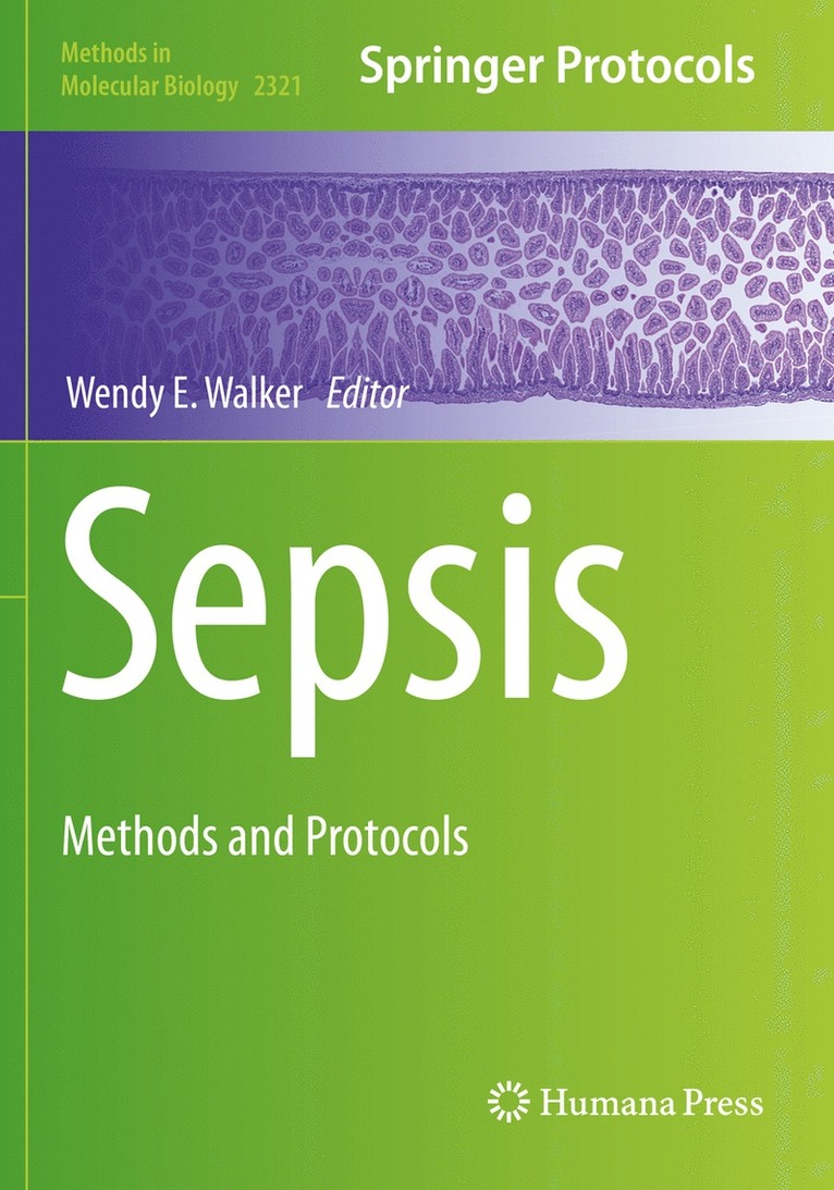 Sepsis