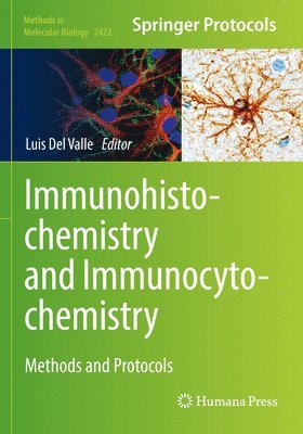 Luis Del Valle, Luis del Valle - Immunohistochemistry and Immunocytochemistry, Häftad
