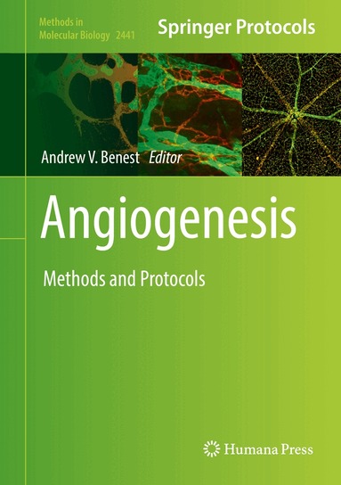 Andrew V. Benest - Angiogenesis, Inbunden