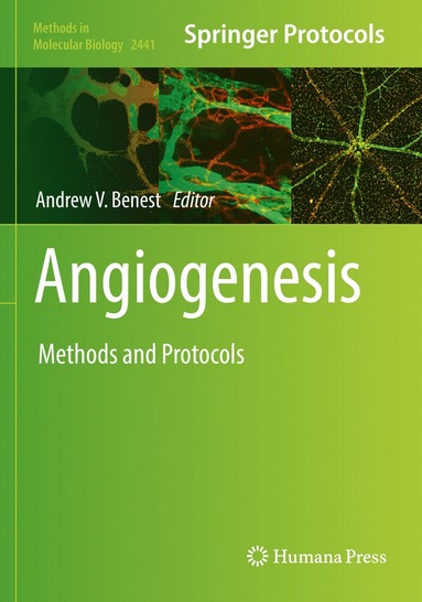 bokomslag Angiogenesis