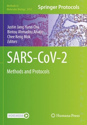 SARS-CoV-2 1