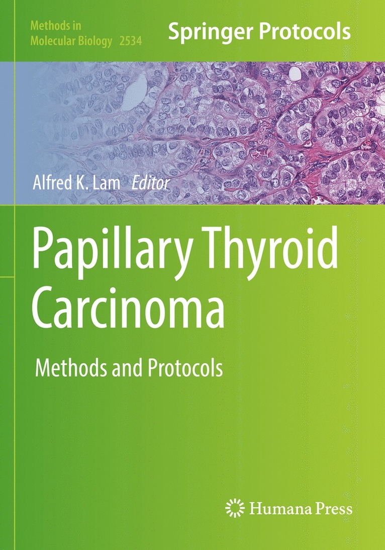 Alfred K. Lam - Papillary Thyroid Carcinoma, Häftad