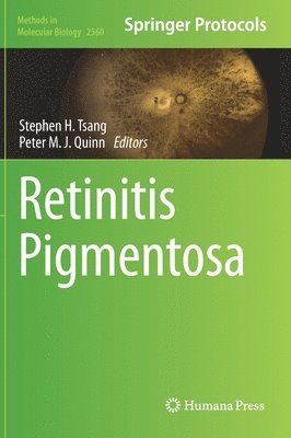 bokomslag Retinitis Pigmentosa