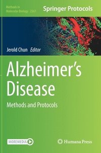 bokomslag Alzheimers Disease