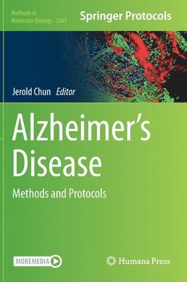 bokomslag Alzheimers Disease