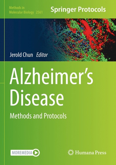 bokomslag Alzheimers Disease