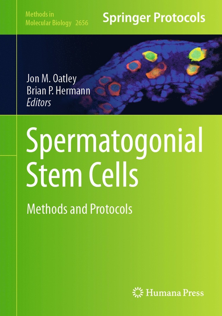 Spermatogonial Stem Cells 1