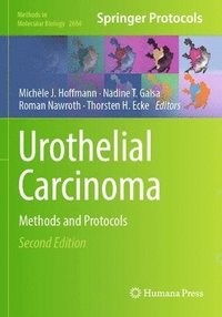 bokomslag Urothelial Carcinoma