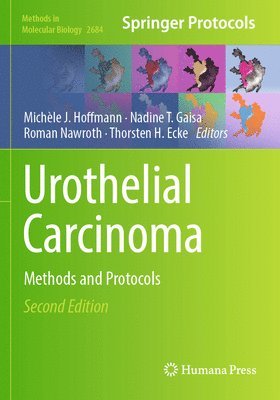 Urothelial Carcinoma 1