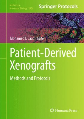 Patient-Derived Xenografts 1