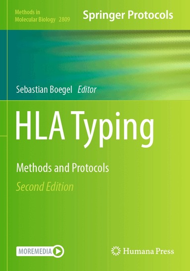 Sebastian Boegel - HLA Typing, Häftad