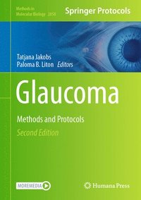 bokomslag Glaucoma