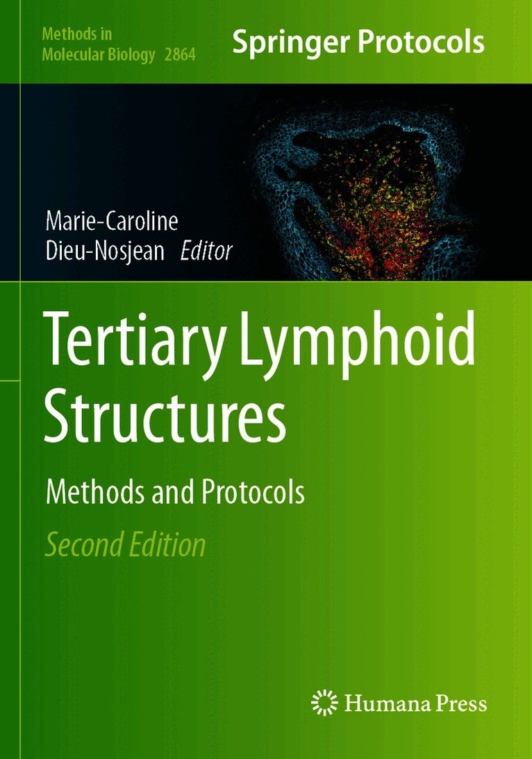 Tertiary Lymphoid Structures