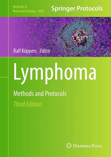 Ralf Küppers - Lymphoma, Inbunden