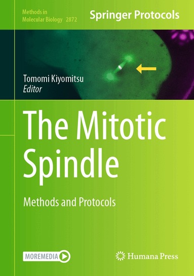 Tomomi Kiyomitsu - Mitotic Spindle, Inbunden