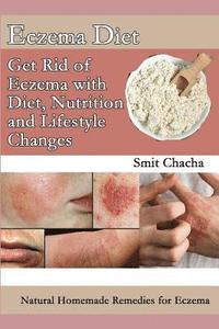 bokomslag Eczema Diet - Get Rid of Eczema with Diet, Nutrition and Lifestyle Changes: Natural Homemade Remedies for Eczema