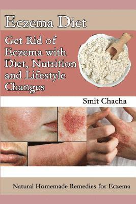 bokomslag Eczema Diet - Get Rid of Eczema with Diet, Nutrition and Lifestyle Changes: Natural Homemade Remedies for Eczema