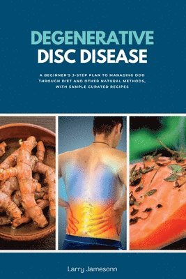 Degenerative Disc Disease 1