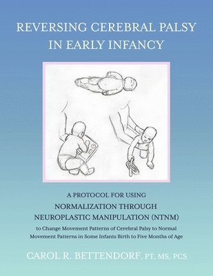 bokomslag Reversing Cerebral Palsy in Early Infancy: A Protocol for Using Normalization Through Neuroplastic Manipulation (Ntnm)