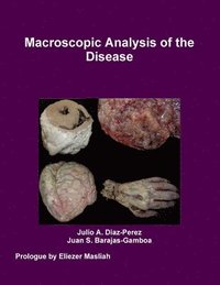 bokomslag Macroscopic Analysis of the Disease