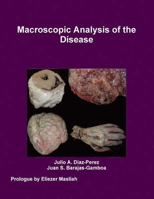 Macroscopic Analysis of the Disease 1