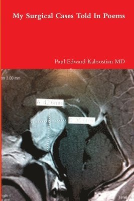 My Surgical Cases Told In Poems