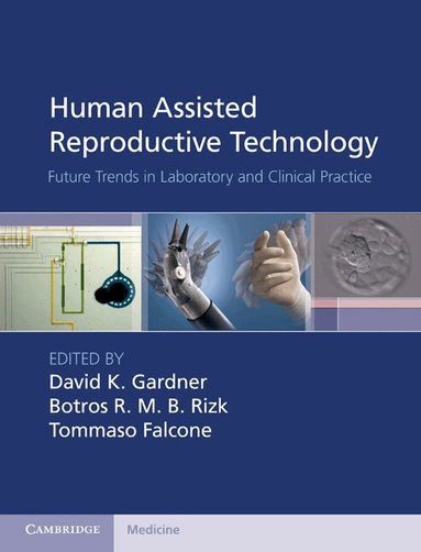 David K. Gardner, Botros R. M. B. Rizk, Tommaso Falcone - Human Assisted Reproductive Technology, Inbunden