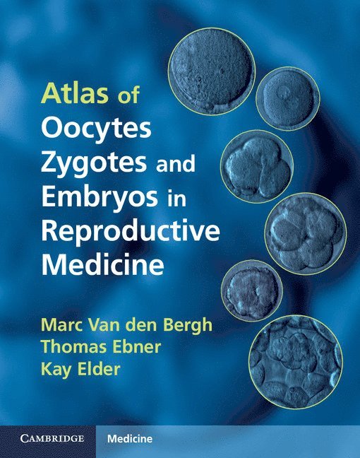 Atlas of Oocytes, Zygotes and Embryos in Reproductive Medicine Hardback with CD-ROM 1