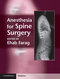 bokomslag Anesthesia for Spine Surgery
