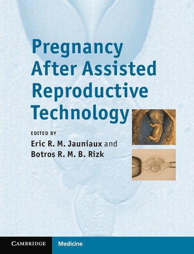 bokomslag Pregnancy After Assisted Reproductive Technology