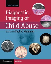 bokomslag Diagnostic Imaging of Child Abuse