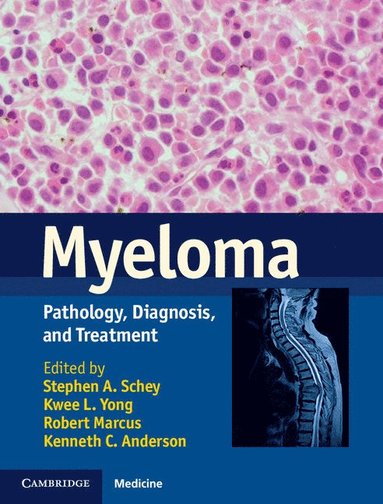 bokomslag Myeloma