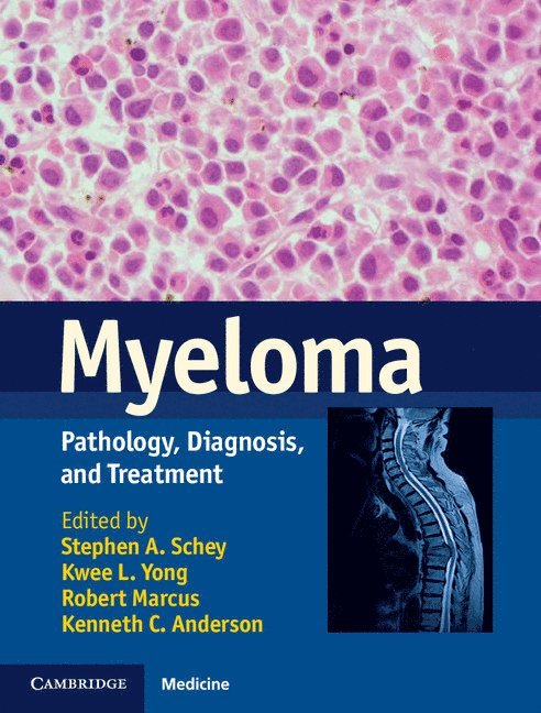 Myeloma 1