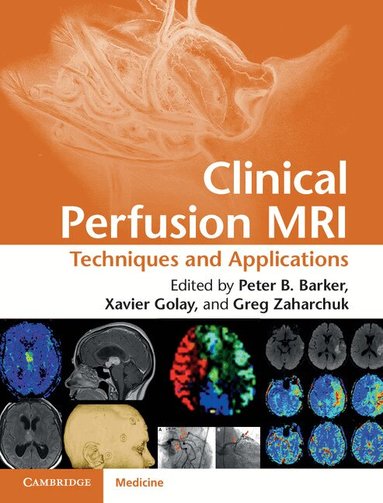 Peter B. Barker, Xavier Golay, Gregory Zaharchuk - Clinical Perfusion MRI, Inbunden