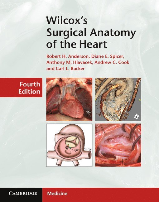 Wilcox's Surgical Anatomy of the Heart 1