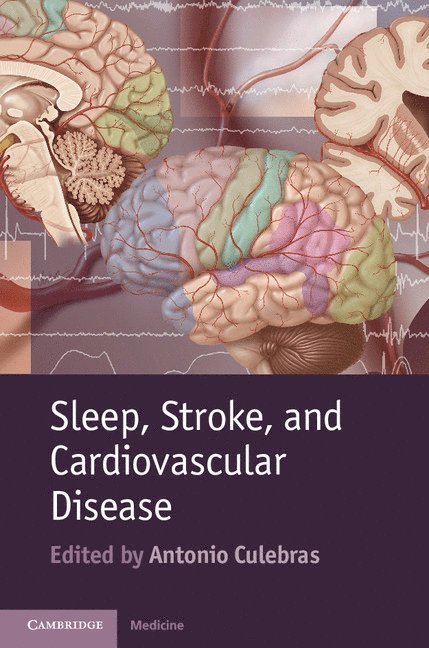 Sleep, Stroke and Cardiovascular Disease 1