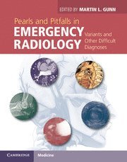 bokomslag Pearls and Pitfalls in Emergency Radiology