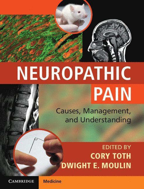 Cory Toth, Dwight E. Moulin, Dwight E Moulin - Neuropathic Pain, Inbunden